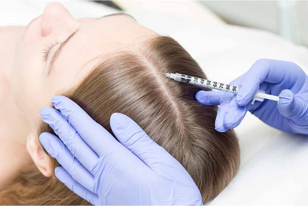 Mulher realizando procedimento estético nos cabelos com aplicação de intradermoterapia capilar.